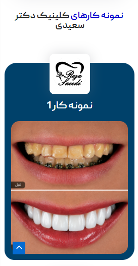 طراحی سایت کلینیک دندانپزشکی — موبایل